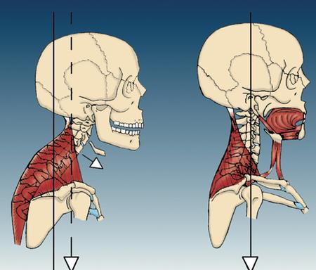 10 Lifting Tips to Prevent Shoulder Injuries Part 1