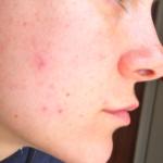 Detoxing can help make skin healthier
